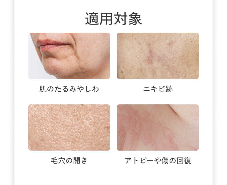 適用対象 ​肌のたるみやしわ ニキビ跡 毛穴の開き アトピーや傷の回復