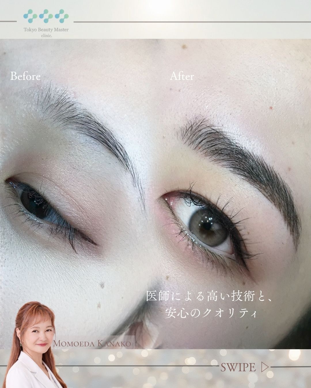 アートメイク