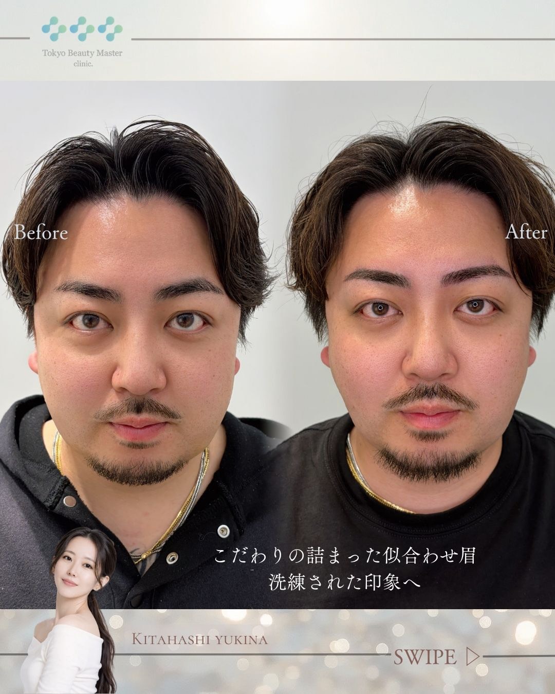 アートメイク